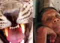 Rabies death Kollam